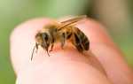Що робити якщо вкусила бджола, перша долікарська допомога, відео